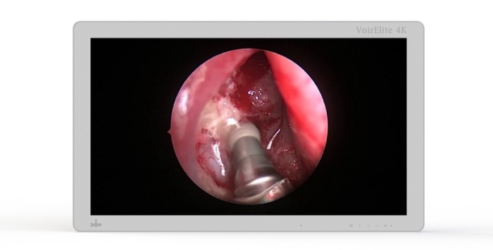 VoirElite 4K Surgical Display