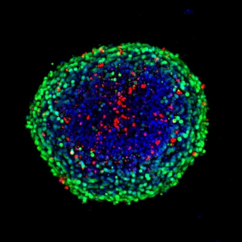 Image Xpress Micro Confocal High-Content Imaging System