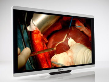 Barco Surgical Displays 