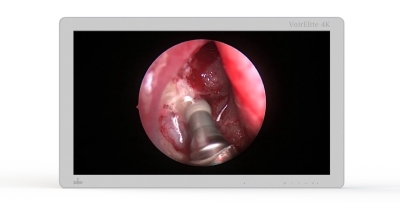 VoirElite 4K Surgical Display